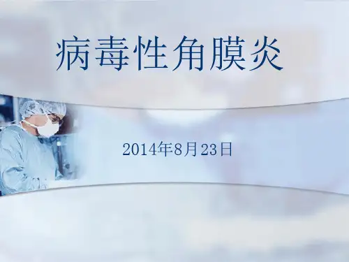 病毒性角膜炎课件