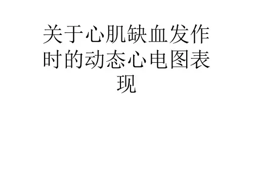 关于心肌缺血发作时的动态心电图表现课件