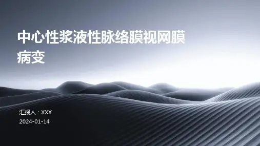 中心性浆液性脉络膜视网膜病变介绍PPT培训课件
