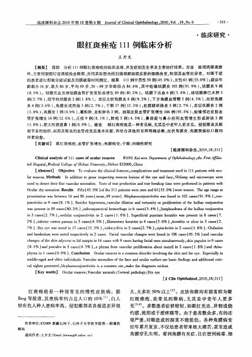 眼红斑痤疮111例临床分析