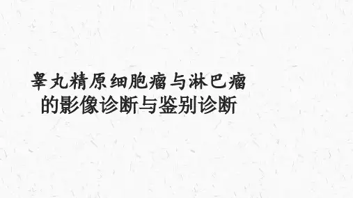 睾丸精原细胞瘤与淋巴瘤的影像诊断与鉴别诊断
