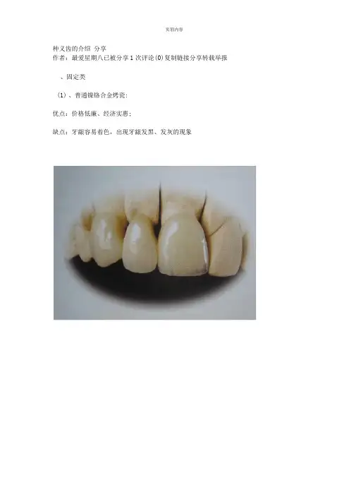 各种义齿的介绍