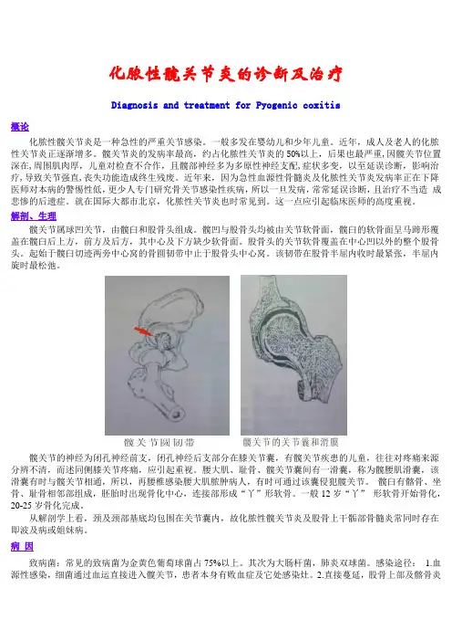 化脓性髋关节炎的诊断及治疗