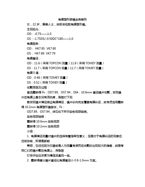 角膜塑形眼镜金典案例