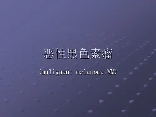 恶性黑色素瘤