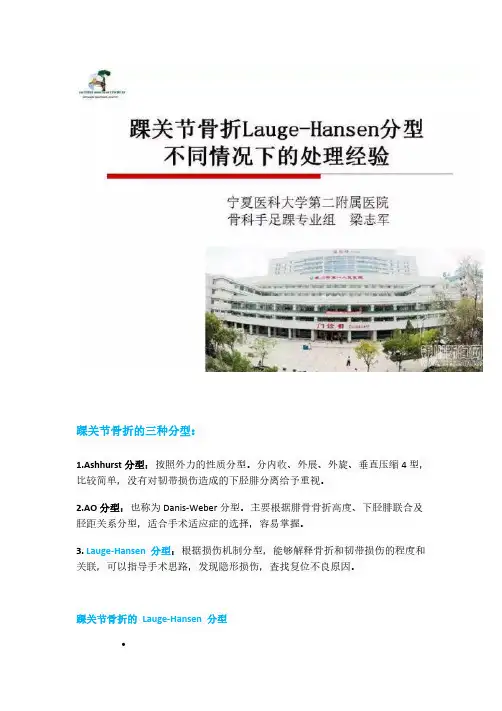 踝关节骨折Lauge-Hansen分型