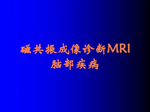 磁共振成像诊断MRI脑部疾病