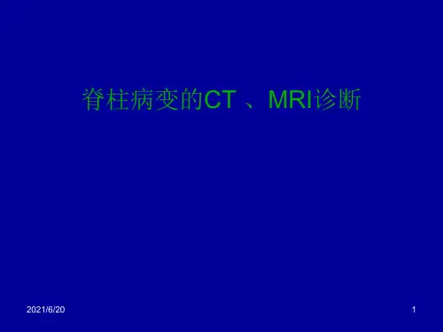 脊柱病变的CT、MRI诊断 课件