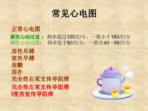 心电图入门讲解ppt课件