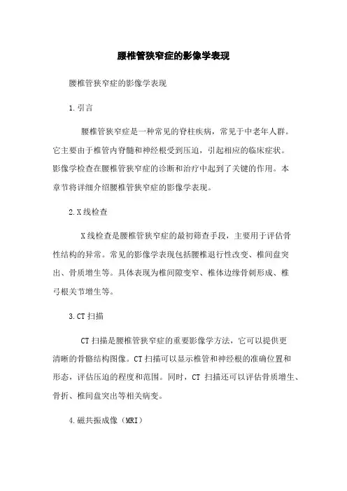 腰椎管狭窄症的影像学表现