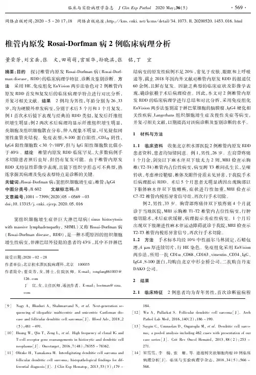 椎管内原发Rosai-Dorfman病2例临床病理分析