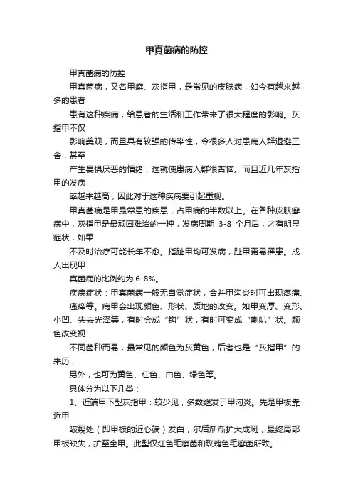 甲真菌病的防控