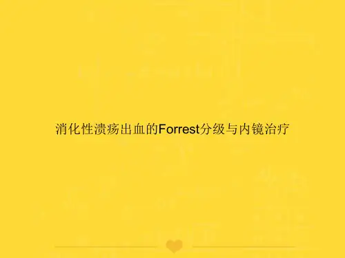 【推选】消化性溃疡出血的Forrest分级与内镜治疗PPT文档