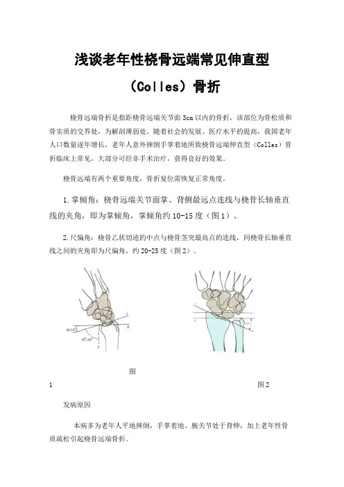 浅谈老年性桡骨远端常见伸直型（Colles）骨折