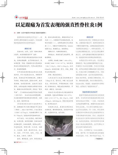 以足跟痛为首发表现的强直性脊柱炎1例