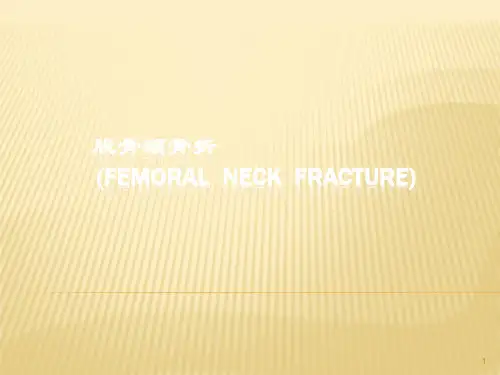 股骨颈骨折