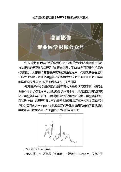 磁共振波谱成像（MRS）解读及临床意义