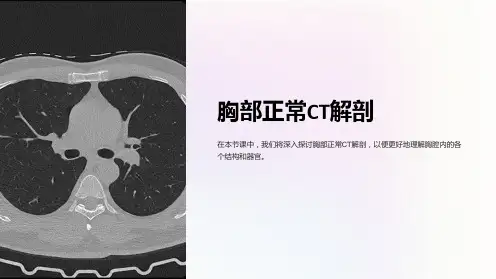 胸部正常ct解剖课件