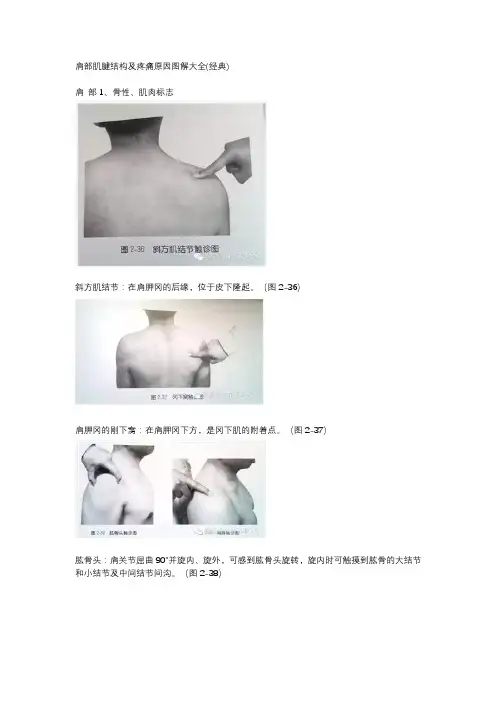 肩部肌腱结构及疼痛原因图解大全