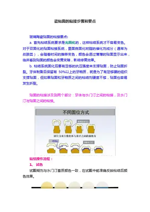 瓷贴面的粘接步骤和要点