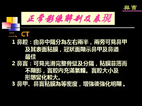 鼻窦正常影像解剖及表现