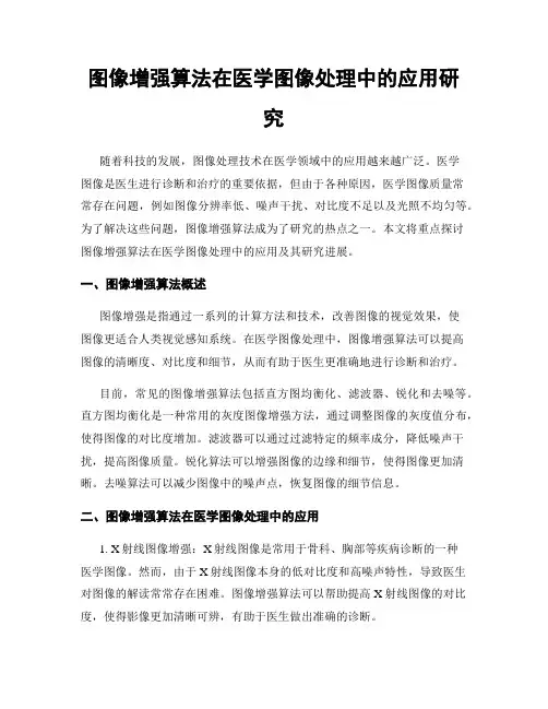 图像增强算法在医学图像处理中的应用研究