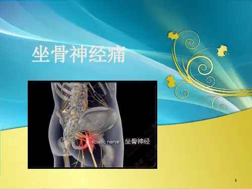 坐骨神经痛ppt课件