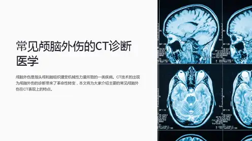 常见颅脑外伤的CT诊断医学