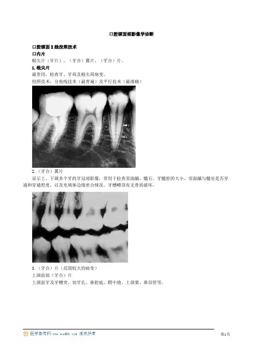 最新口腔执业医师(含助理)精品资料口腔颌面部影像学诊断