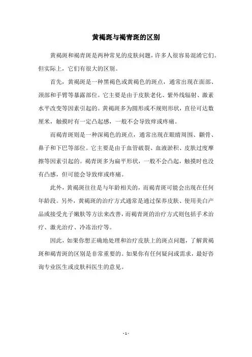 黄褐斑与褐青斑的区别