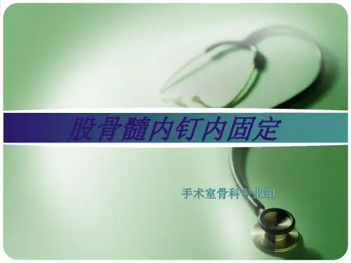 股骨髓内钉内固定术课件