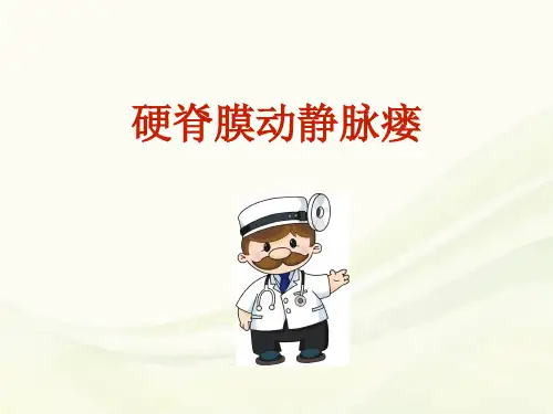 (医学课件)硬脊膜动静脉瘘