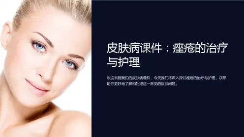 “皮肤病课件：痤疮的治疗与护理”