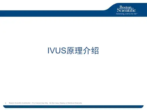IVUS原理介绍课件