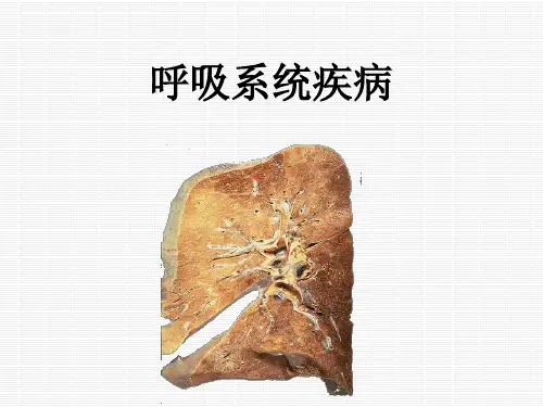 病理慢支炎 肺气肿 肺心病