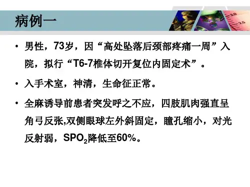 癫痫和麻醉专题知识宣教