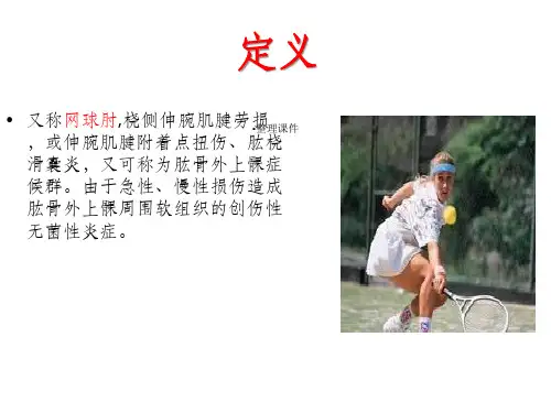肱骨外上髁炎课件