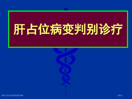 肝脏占位性病变的鉴别诊断
