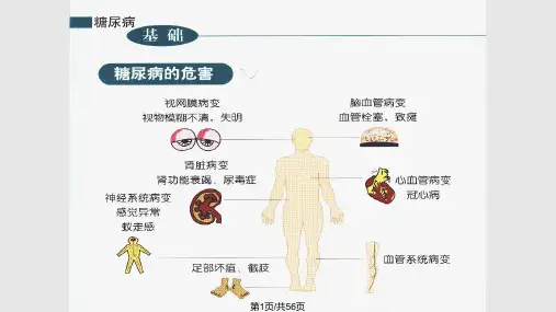 糖尿病的病因及发PPT课件