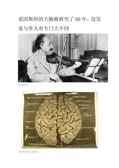 爱因斯坦的大脑被研究了60年,没发现与常人有专门大不同