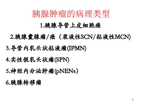 胰腺肿瘤的病理类型PPT课件