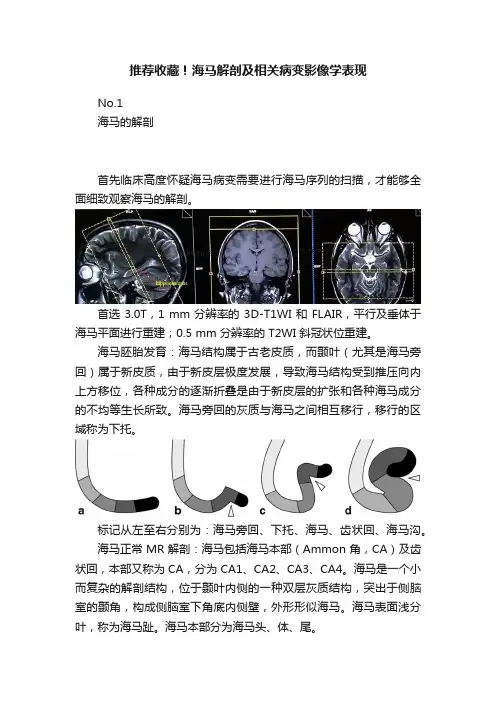 推荐收藏！海马解剖及相关病变影像学表现