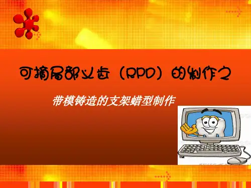 可摘局部义齿(RPD)的制作