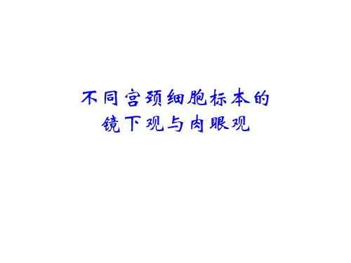 不同宫颈标本镜下观及肉眼观