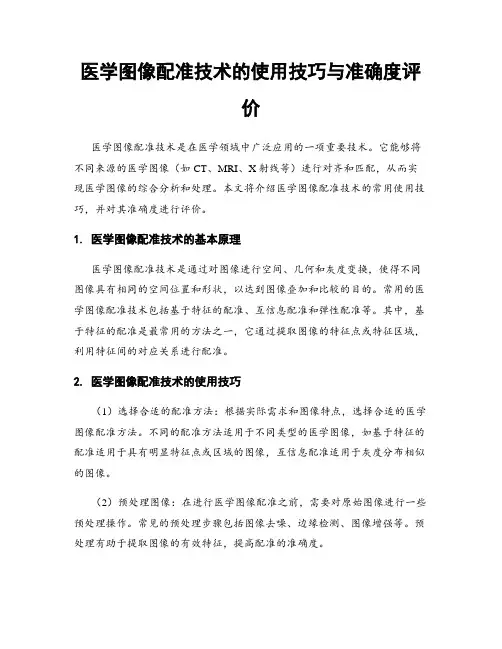 医学图像配准技术的使用技巧与准确度评价