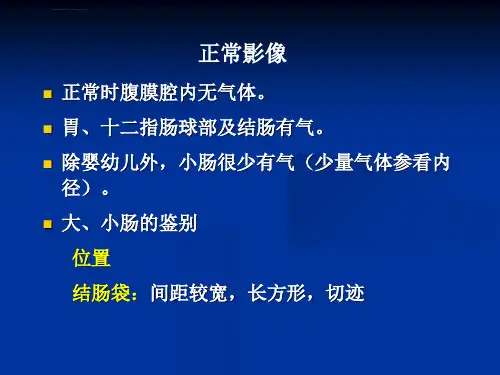肠梗阻分类与影像学表现ppt课件