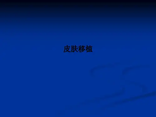 皮肤移植PPT课件【11页】