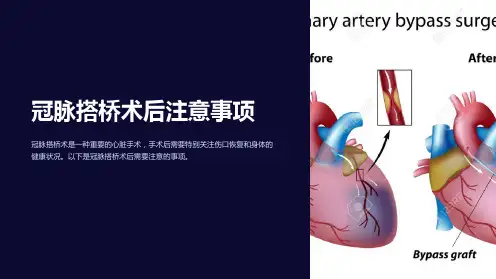 冠脉搭桥术后注意事项