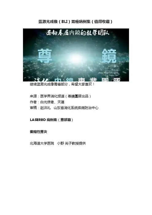 蓝激光成像（BLI）胃癌病例集（值得收藏）