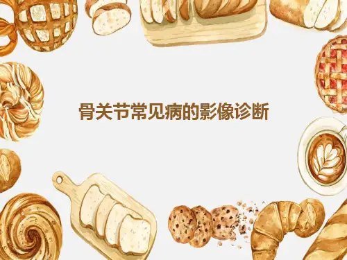 骨与关节常见病的影像诊断